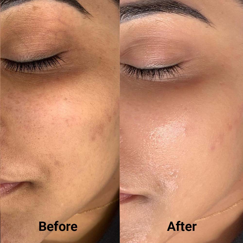 Korean Advanced PDRN Copper Peptide Serum